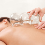 arya care - bekam 1