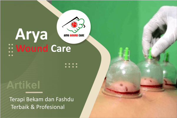 arya care - artikel - terapi bekam